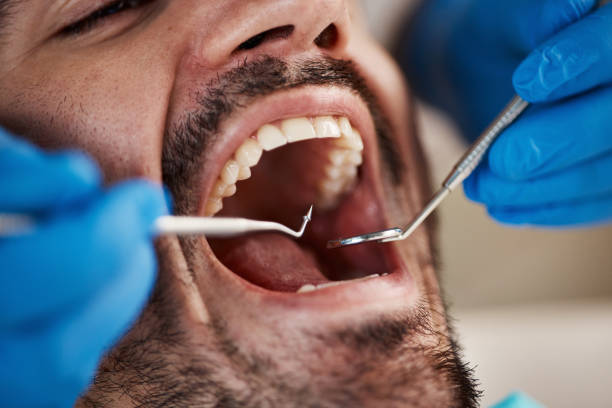 Best Emergency Dental Care for Broken or Chipped Teeth in Cornville, AZ